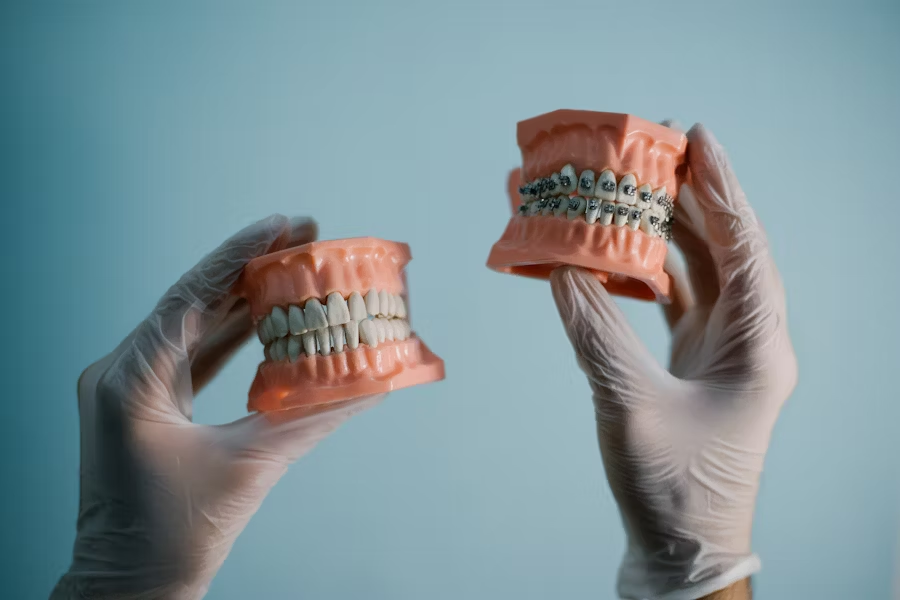 Dental Implants vs Dentures in Singapore: Weighing Long-Term Costs and Benefits